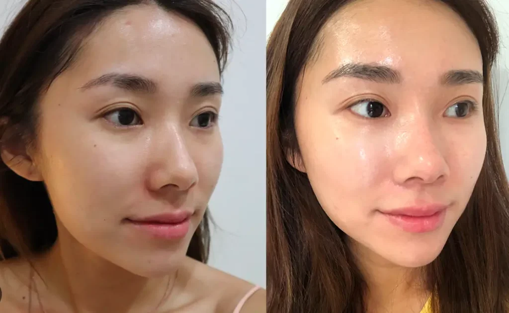 collagen boost collagen boost