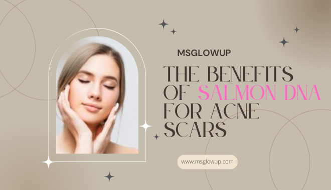 The Benefits of Salmon DNA for Acne Scars